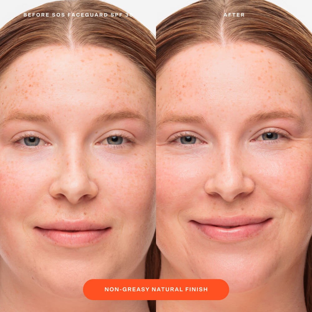 SOS FaceGuardTM SPF 30 Sunscreen PA+++